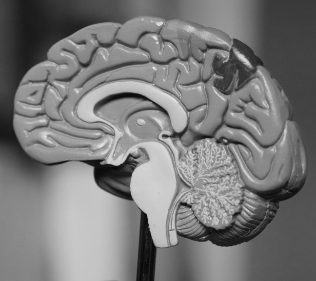 photo of a brain model